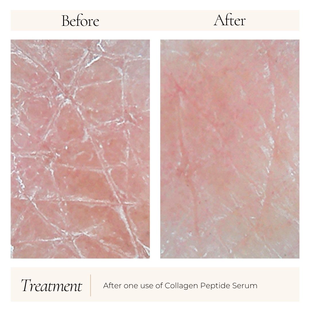 Collagen_Peptide_before_after.jpg